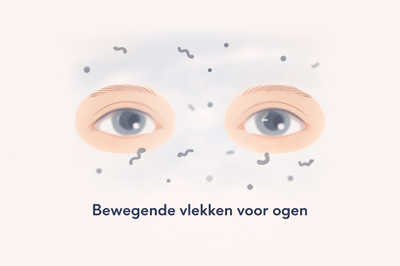 Bewegende vlekken voor ogen