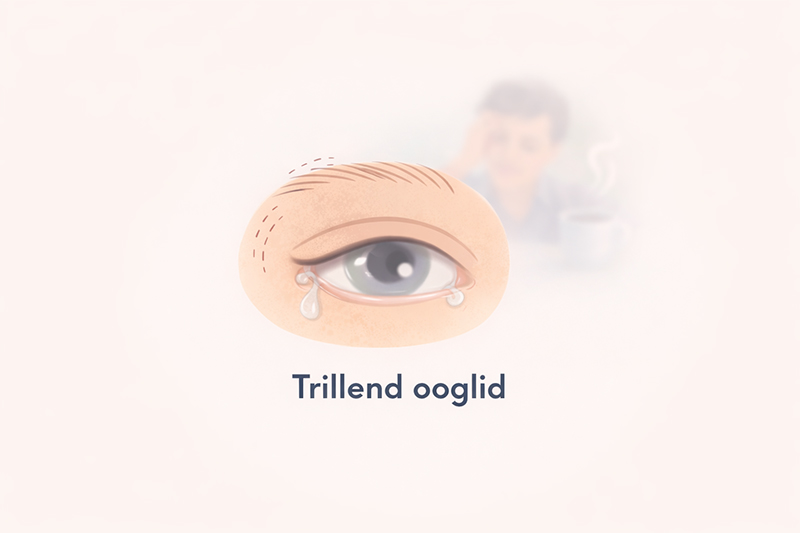 Trillend ooglid